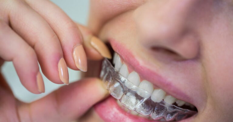 Open Graph Universal